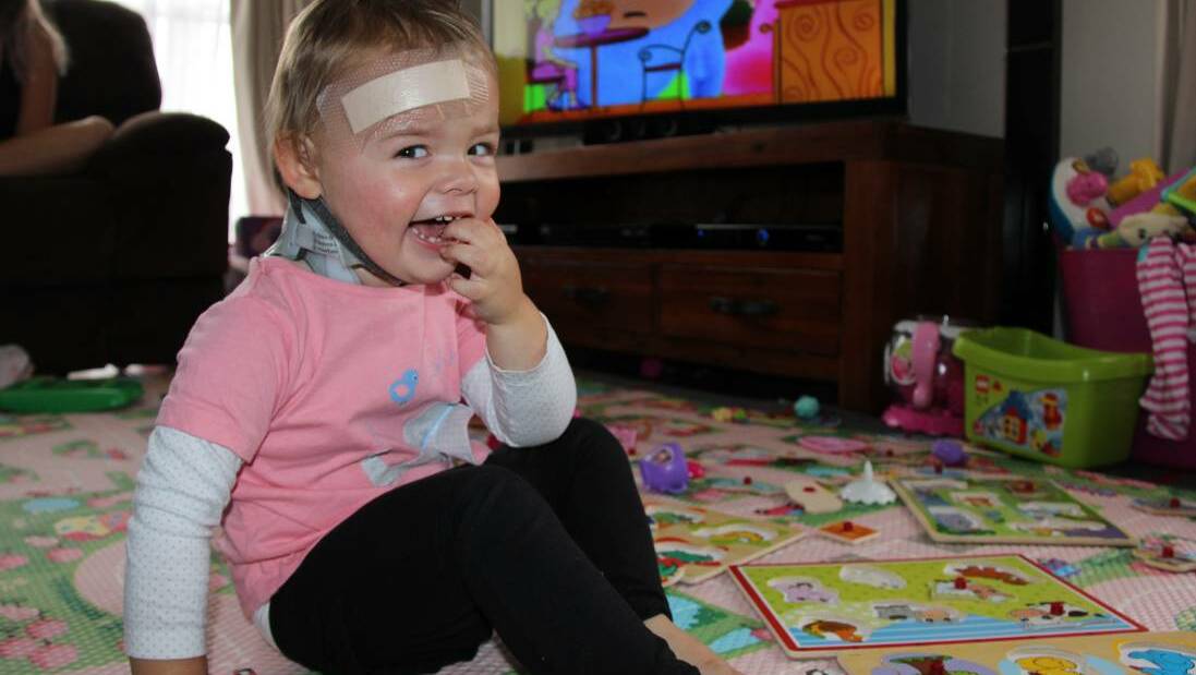 Summer now has a small scar on her forehead to show for the months in hospital. Photo: Mudgee Guardian