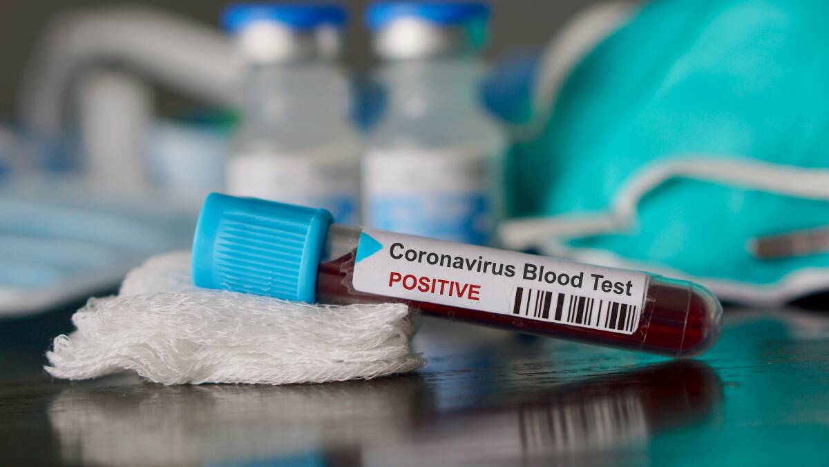 POSITIVE: A new case of coronavirus has been confirmed in the region overnight. Photo: SHUTTERSTOCK